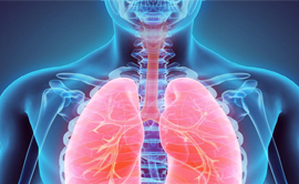 Sarcoidosis Specialist in Gurgaon